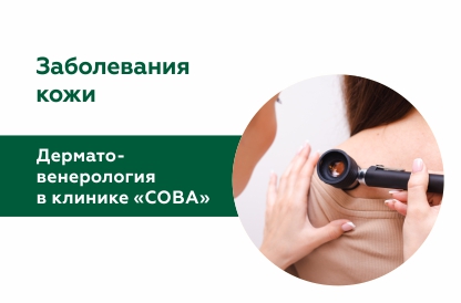 Дерматовенерология в клинике «СОВА»