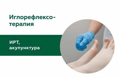 Иглорефлексотерапия (ИРТ, акупунктура)