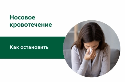 Остановка носового кровотечения