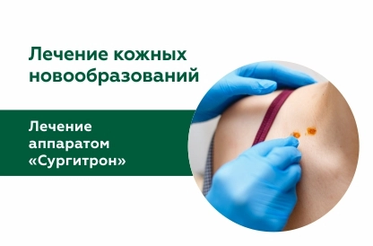 Лечение новообразований аппаратом “Сургитрон”