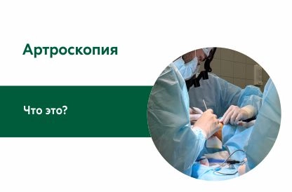 Артроскопия. 