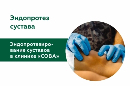 Эндопротезирование суставов в клинике «СОВА»
