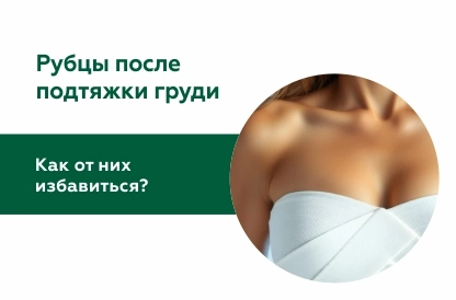 Как избавиться от рубцов после подтяжки груди
