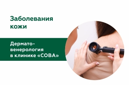 Дерматовенерология в клинике «СОВА»
