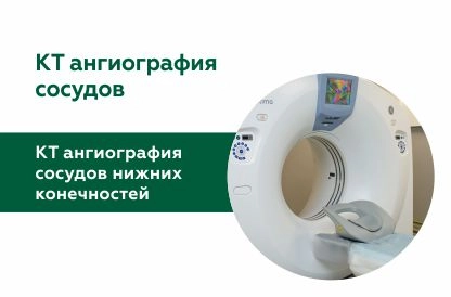 КТ-ангиография сосудов нижних конечностей 