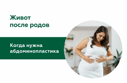 Живот после родов: когда не обойтись без абдоминопластики?