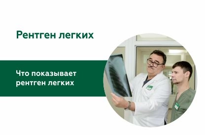 Рентген лёгких