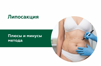 Что такое липосакция?